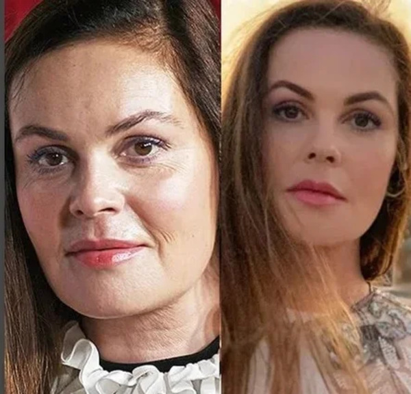 Екатерина андреева пластика до и после лица фото